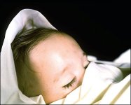 1.	Andr&eacute;s Serrano ‘Meningitis Fatal’ de la serie 'La morgue' 1992