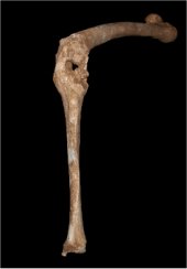 Pierna izquierda donde puede verse la anquilosis y el agujero causados por un lanzazo, razones por las que se cree que ser&iacute;a Filipo II